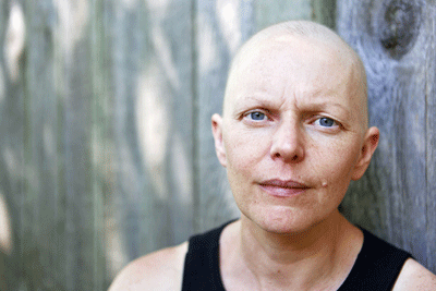 bald cancer patient